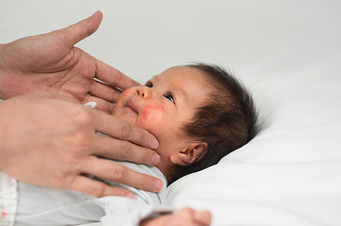 赤ちゃんに発生する皮膚感染症を克服する方法