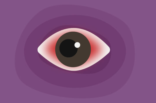 Ето как конюнктивитът причинява червени очи