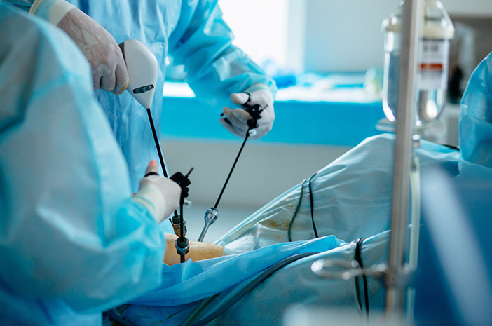 Perbezaan antara apendektomi dan laparoskopi