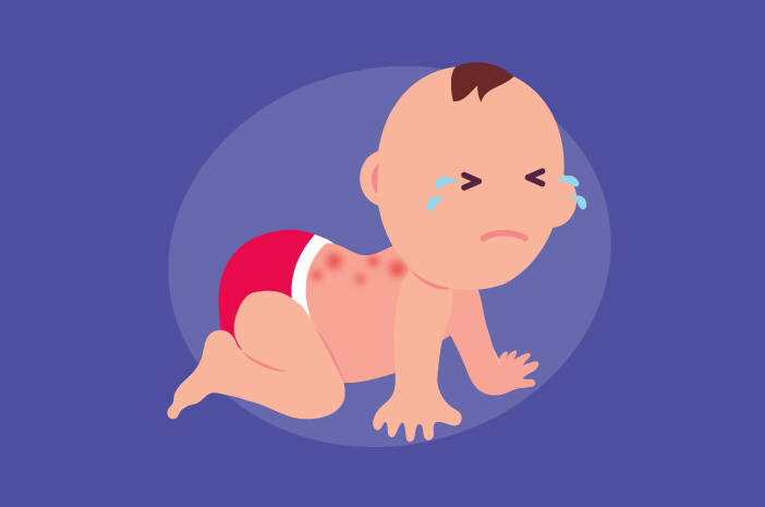 Разпознайте симптомите и причините за децата, засегнати от вируса на рубеола