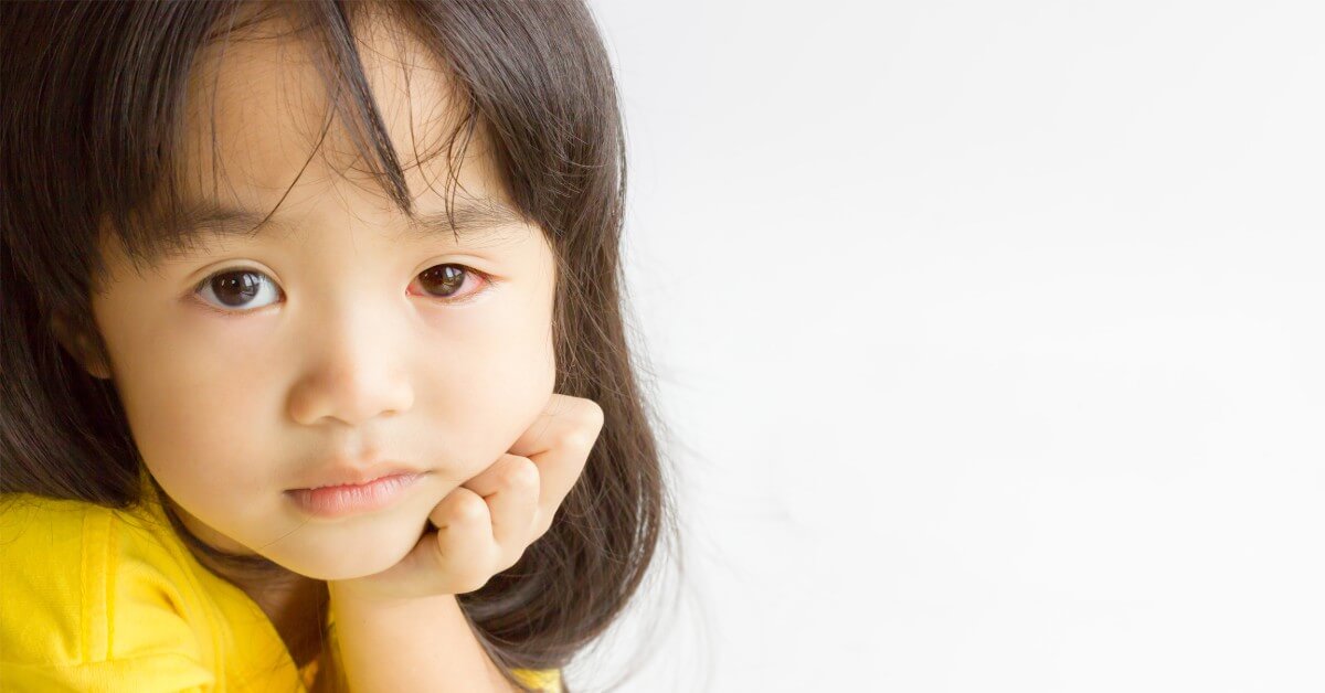 تعرف على أسباب حساسية العين عند الأطفال