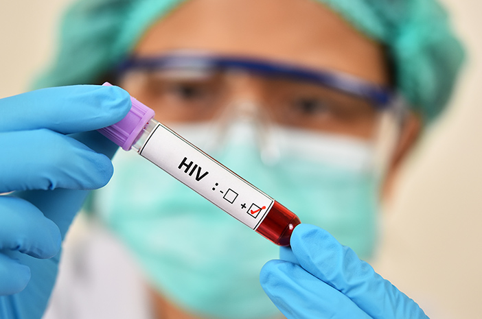 2 اختبارات لكشف فيروس نقص المناعة البشرية الإيدز في الجسم