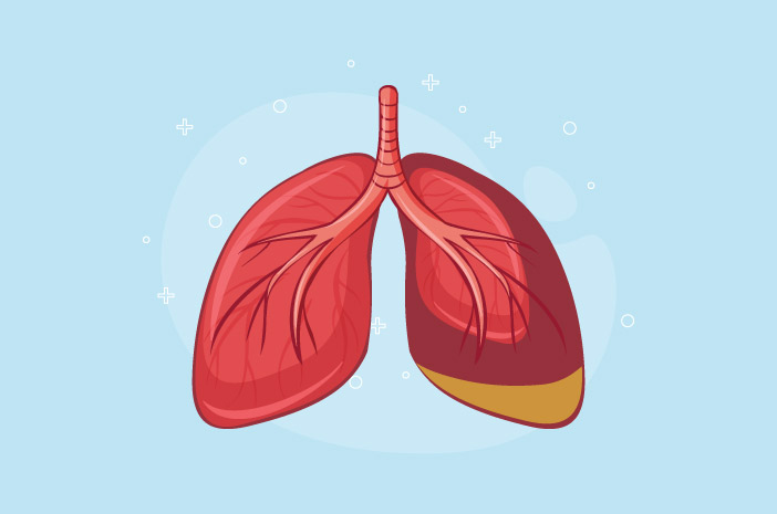 3 вида лекарства за пневмония въз основа на причината