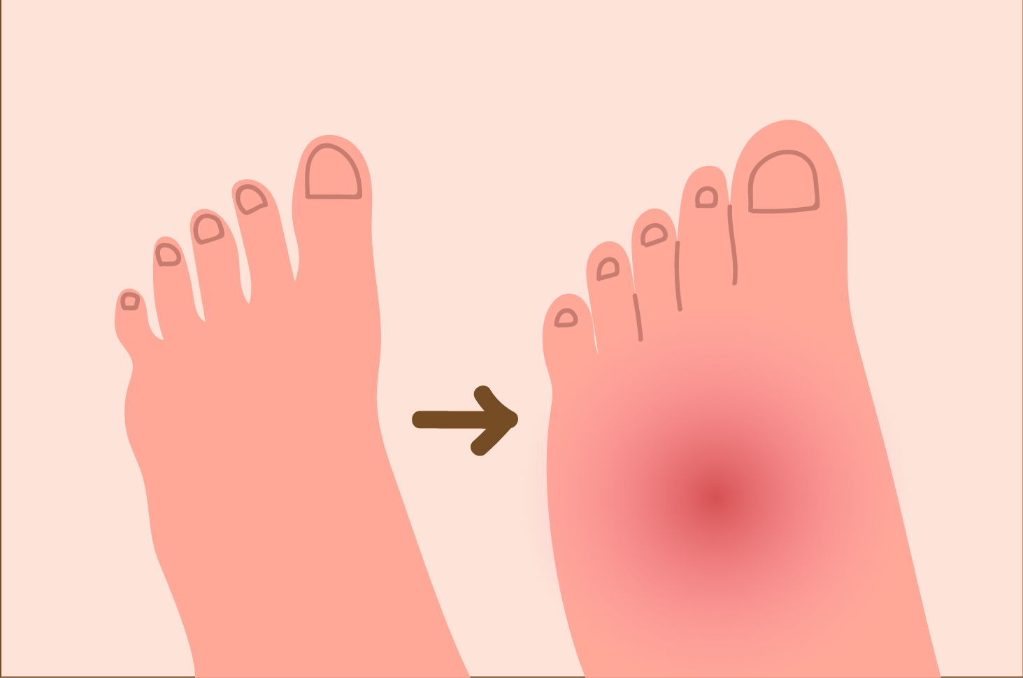 出産後の足のむくみを克服するための8つの効果的なステップ