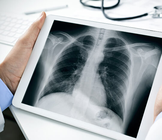 Могат ли рентгеновите лъчи да причинят странични ефекти?