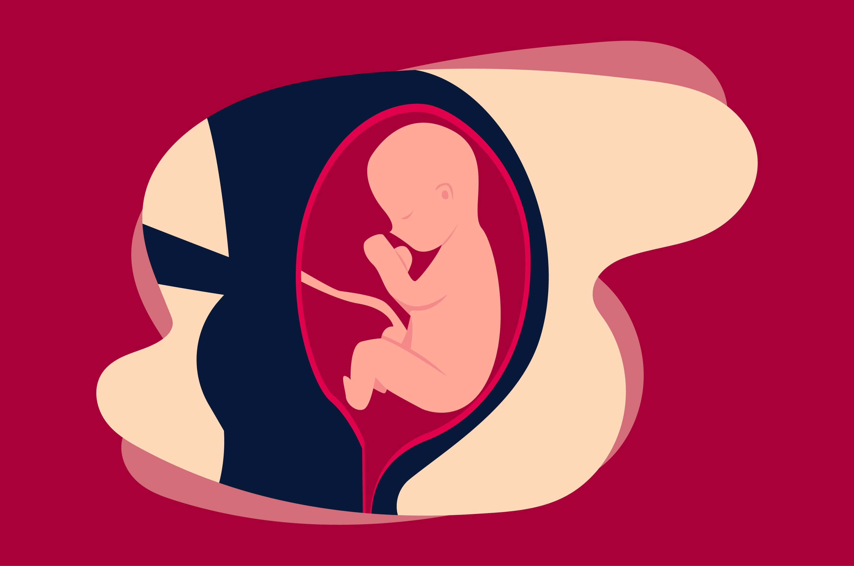 Wanita hamil perlu tahu, berikut adalah 3 posisi untuk bayi breech