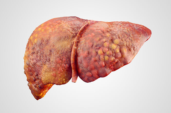 慢性肝疾患の主な原因は何ですか？
