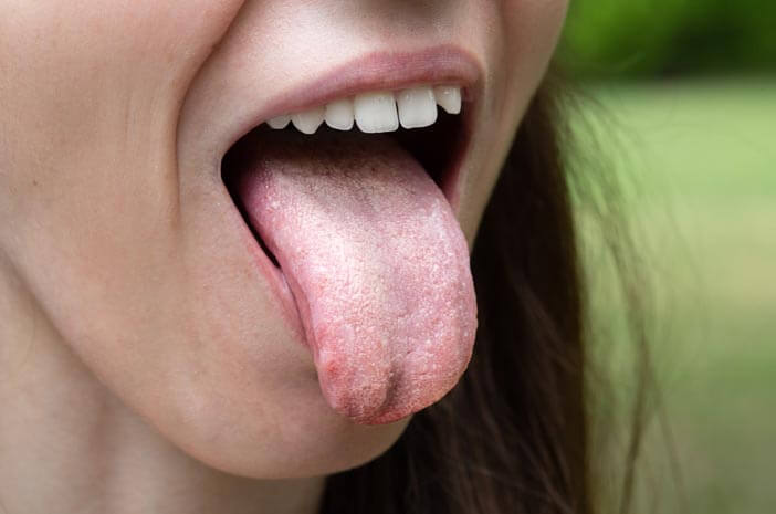 Нездравословните интимни отношения могат да предизвикат рак на езика?