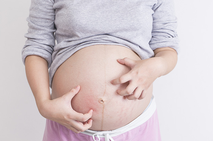 Come trattare le infezioni della pelle che si verificano durante la gravidanza