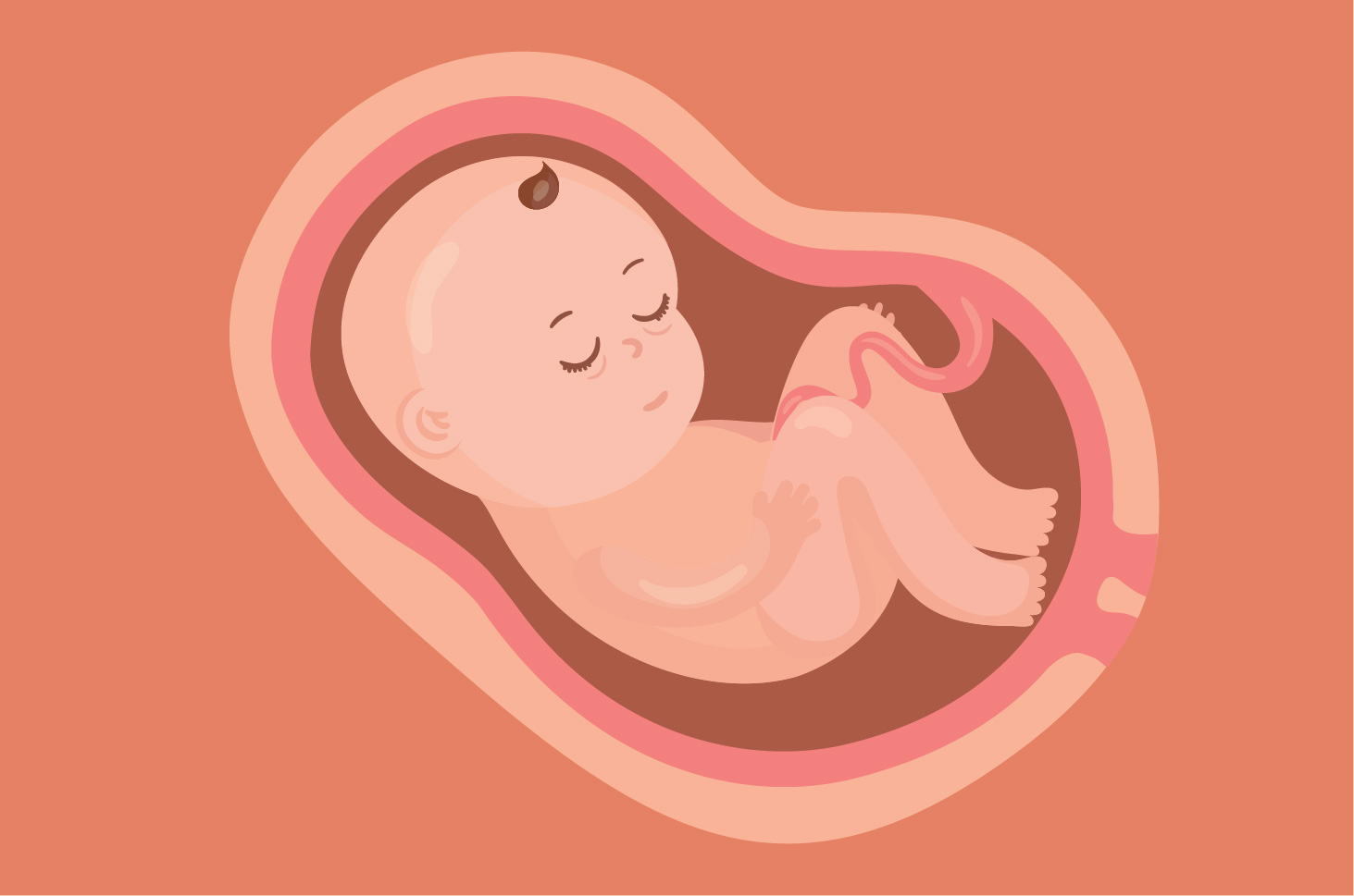Conoscere IUFD, morte fetale nell'utero