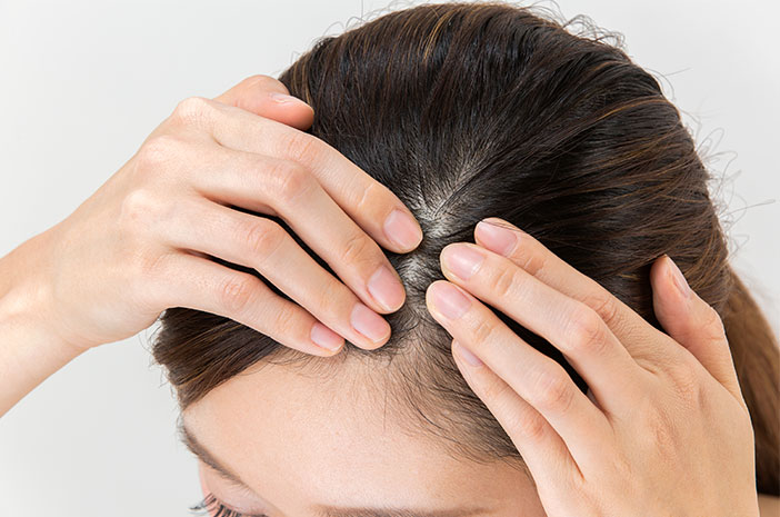 تطبيق الصبار يمكن أن يمنع تساقط الشعر