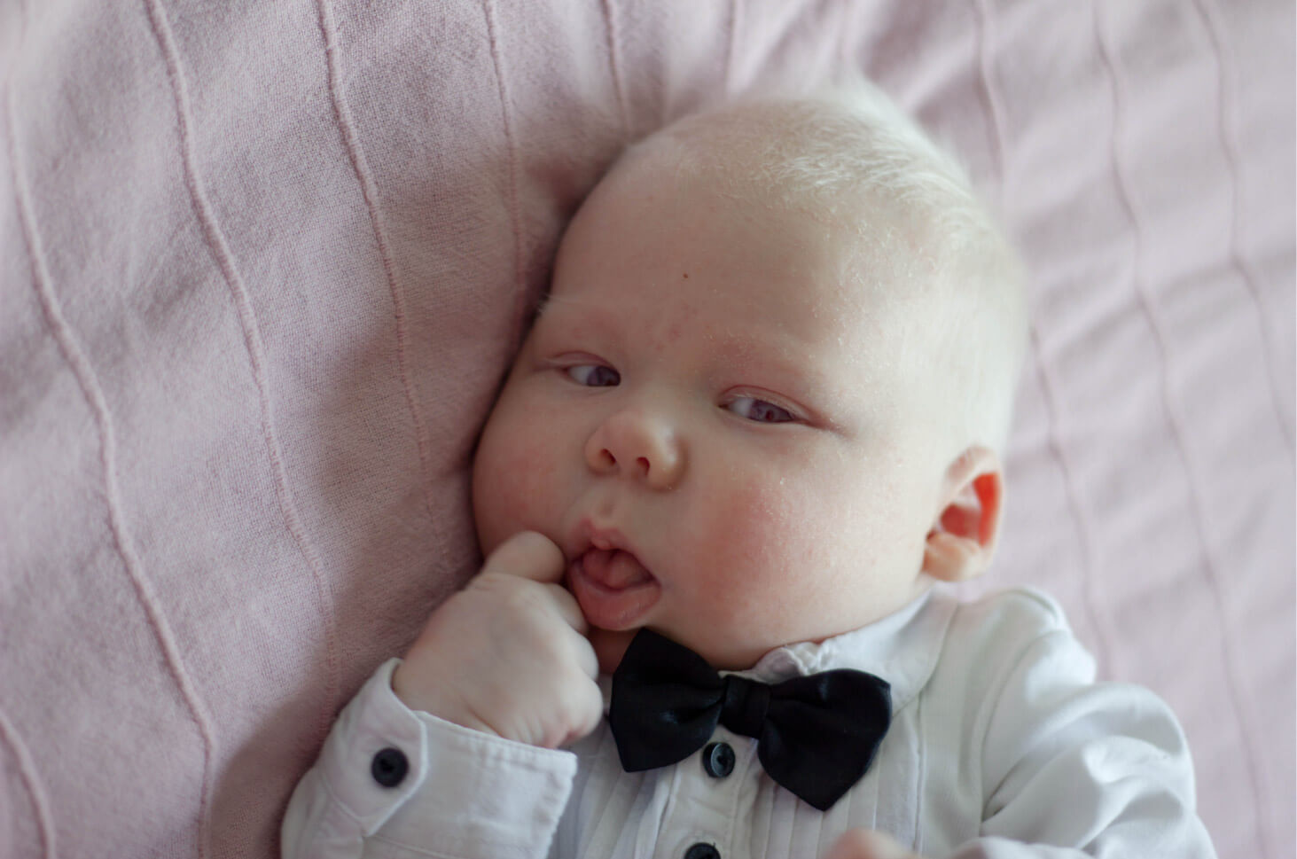 7 fatti che devi sapere sull'albinismo