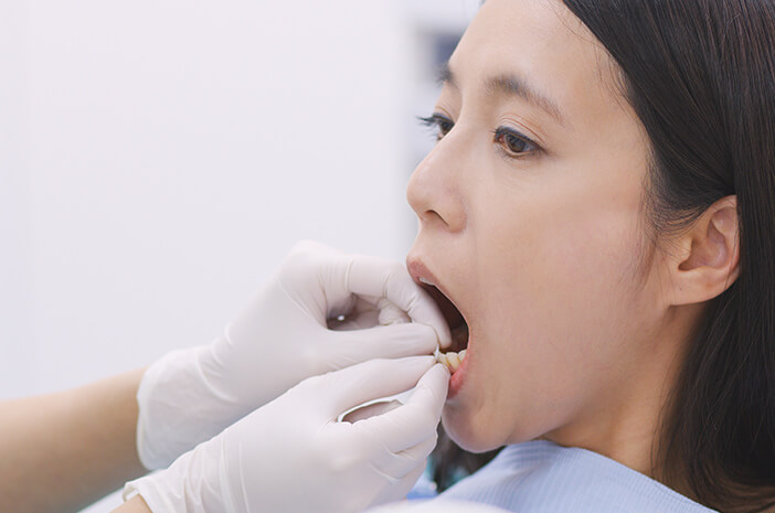 しなければならない、断食中に抜歯することはできますか？