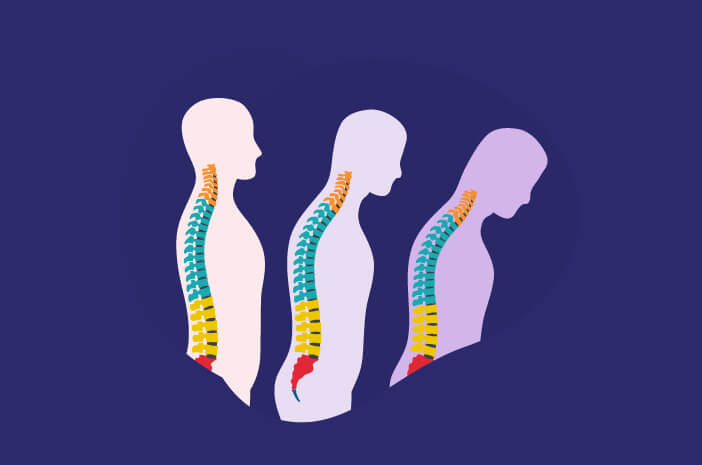 Untuk tulang rapuh, ini adalah perbezaan antara Osteomalacia dan Osteoporosis